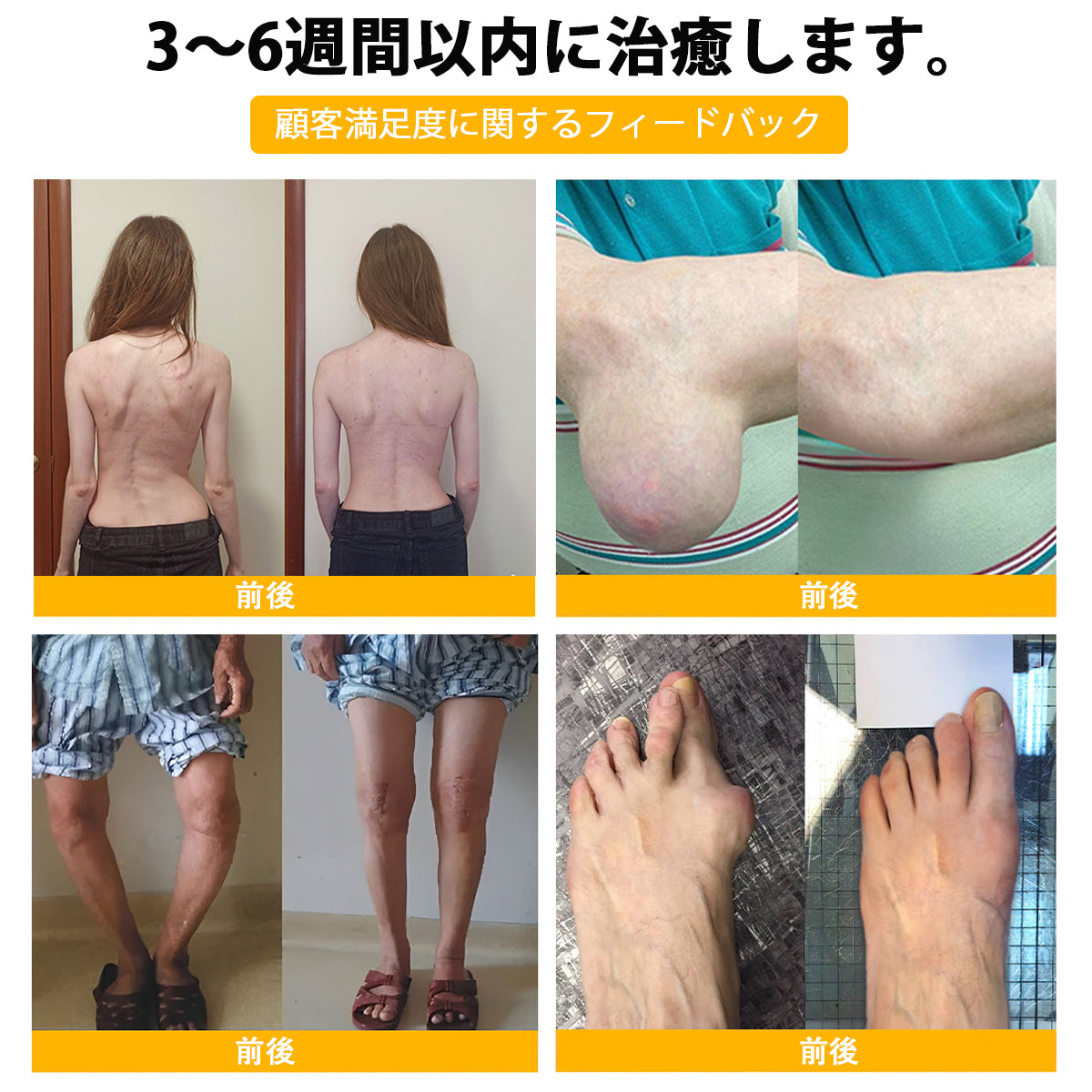 BSWELL® ハチ毒エキス配合 関節ケアクリーム｜関節サポート・膝・腰・肩の違和感ケア｜ニュージーランド産原料使用 高機能リペアクリーム